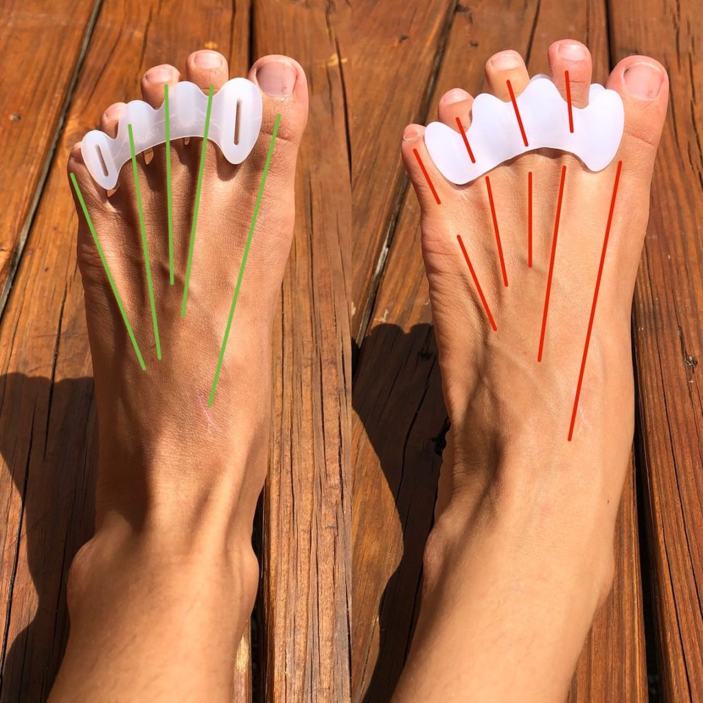 Only Happy Feet Brings You This Type Of Foot Relief Toe Separator