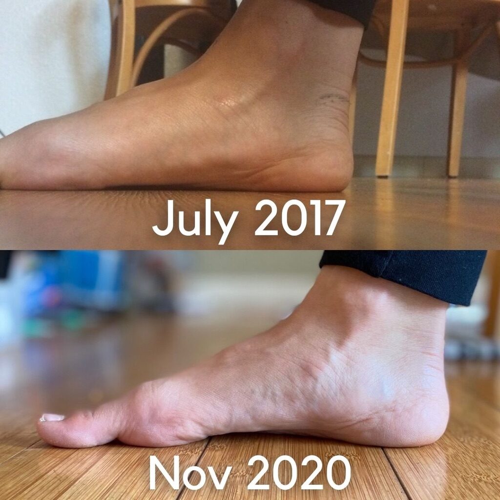 My Journey to Strong Feet & Barefoot Shoes