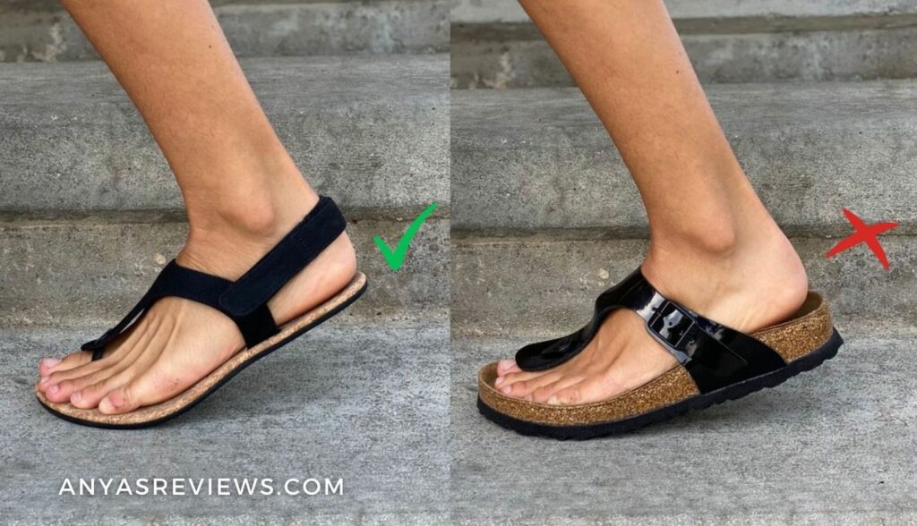 Why Birkenstocks Aren't a Long Term Solution to Foot Pain