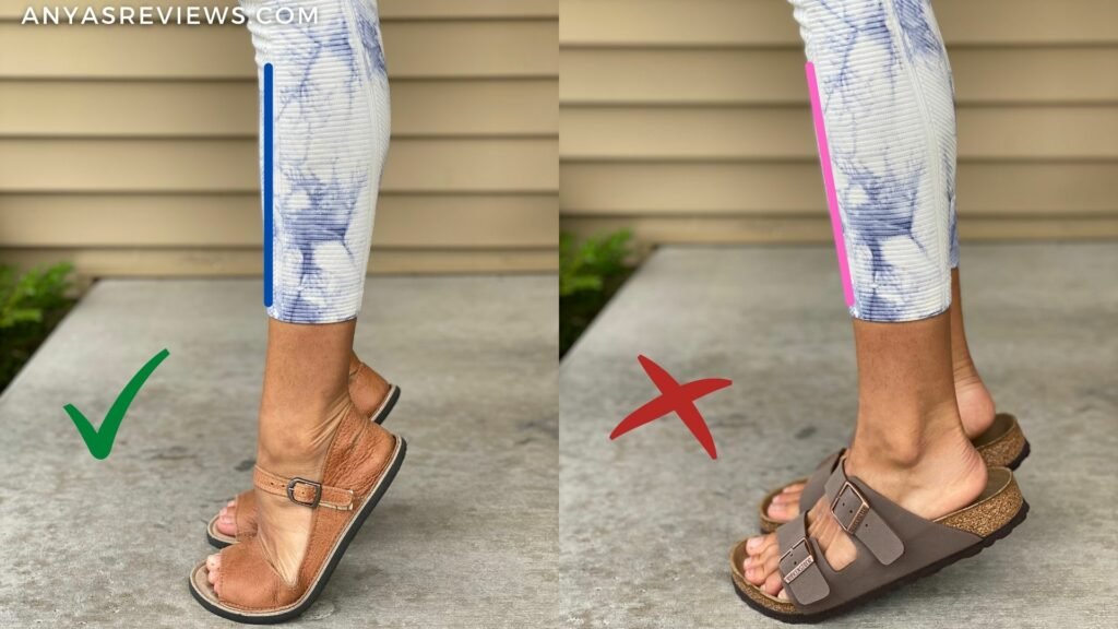 Why Birkenstocks Aren't a Long Term Solution to Foot Pain | Reviews