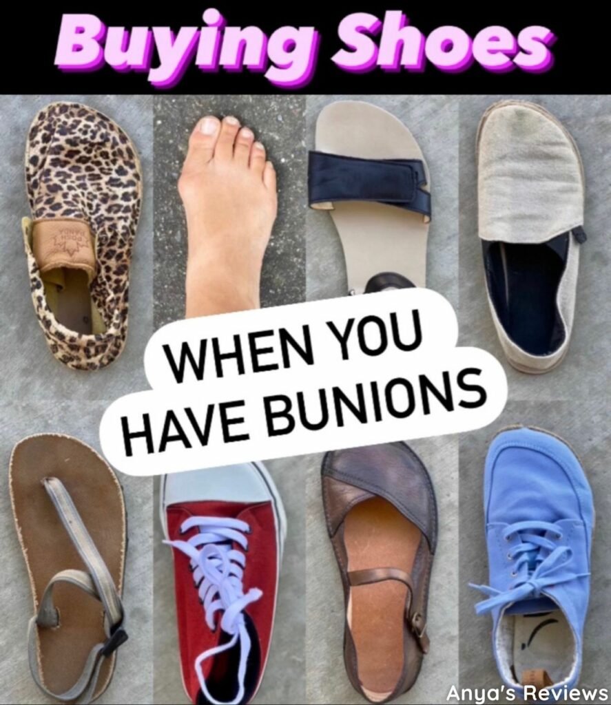 The Ultimate Guide to the Best Shoes for Bunions