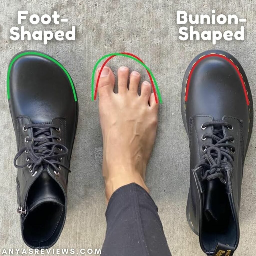 Do bunion store shoes work