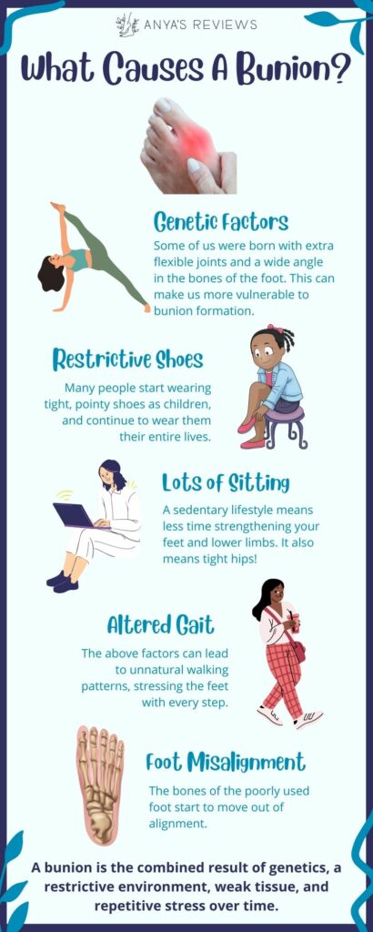 An infographic showing that the cause of bunions is multifactoral and involves genetics, ill fitting shoes, excessive sitting, and poor gait.